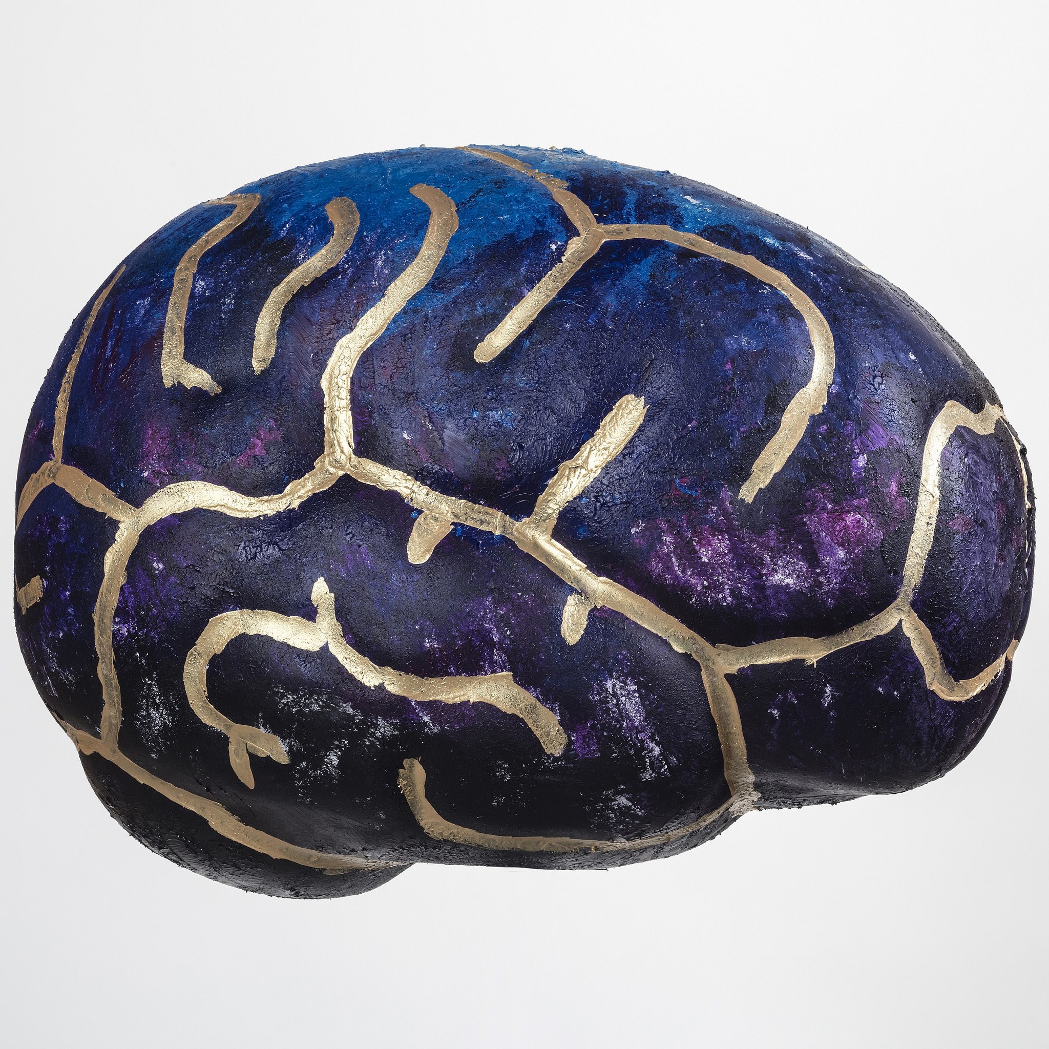 Photo courtesy of The Brain Project