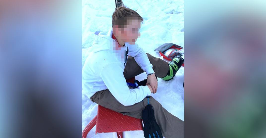 Police renew appeal after youth’s skull pierced by ski pole on Grouse Mountain