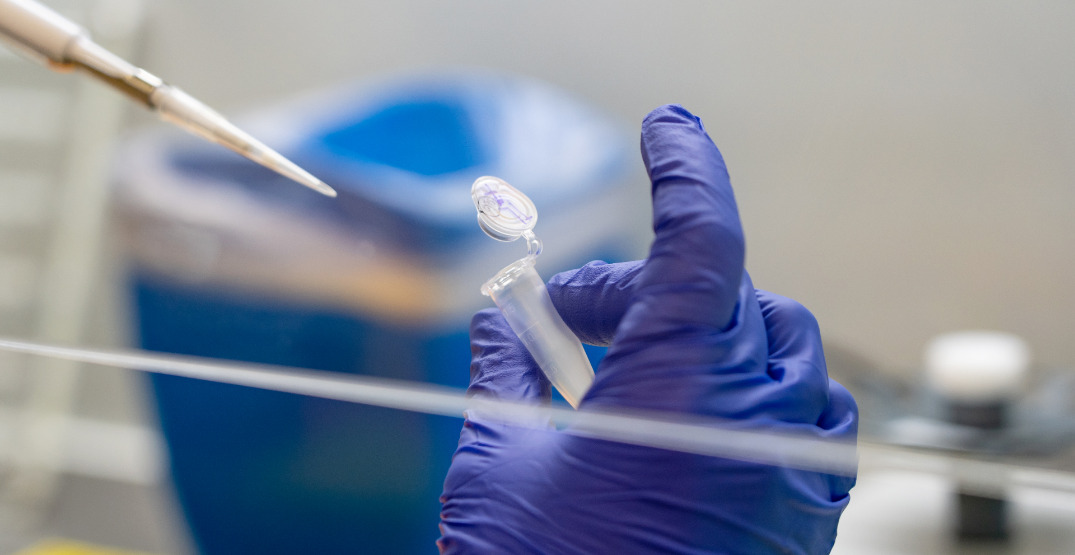 Washington State confirms its first case of monkeypox