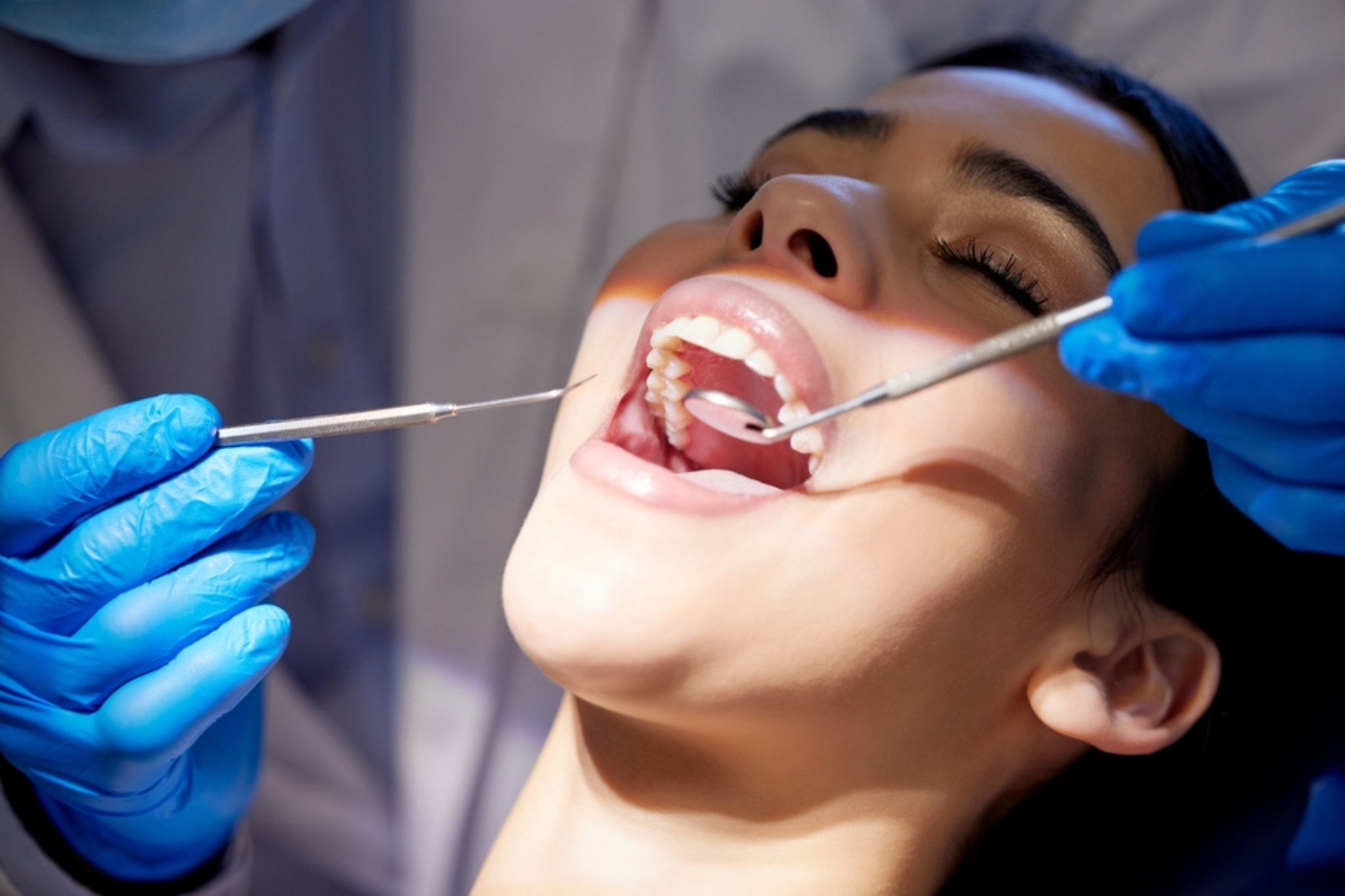 Canadian Dental Care Plan expanding eligibility next month