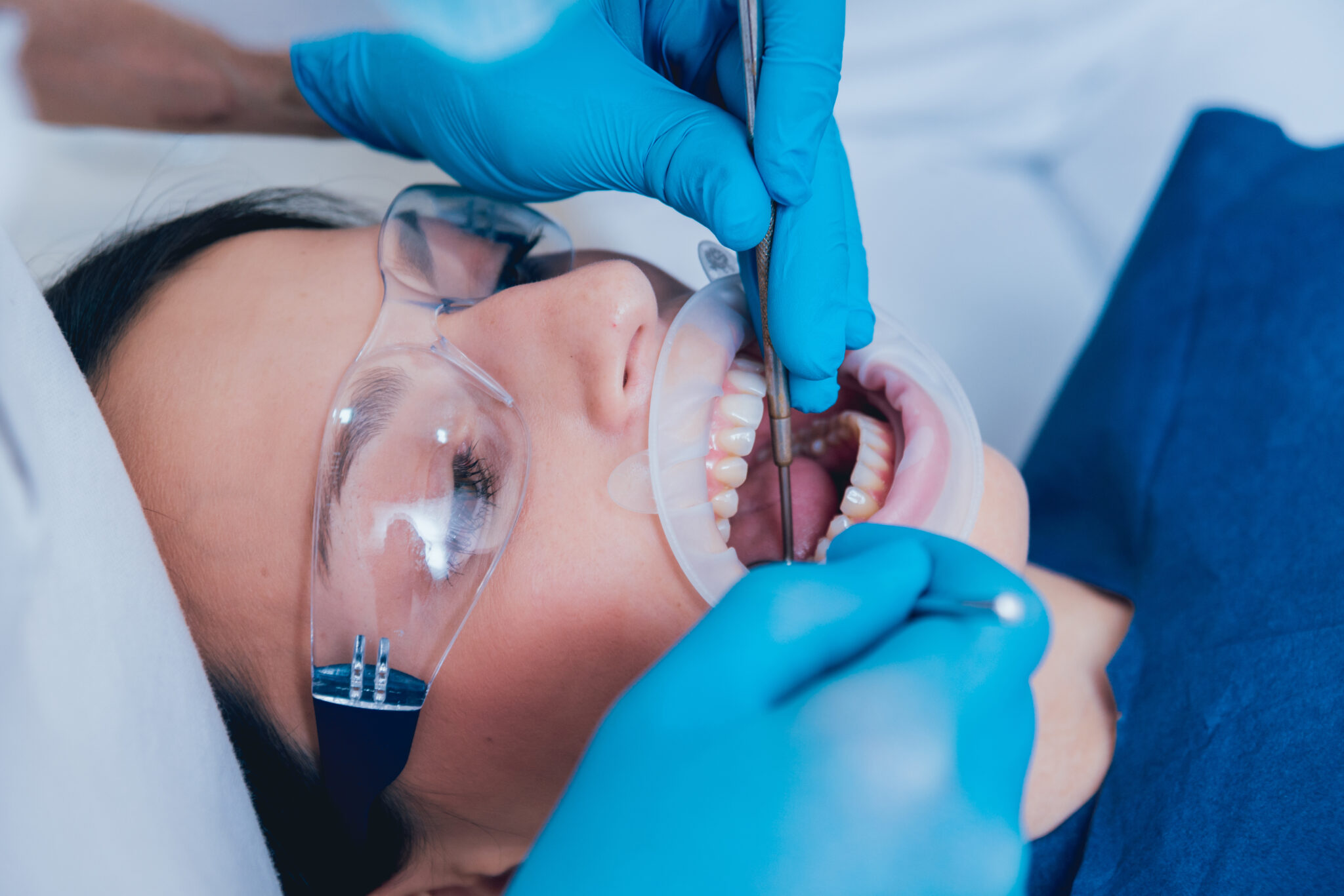 canada dental plan