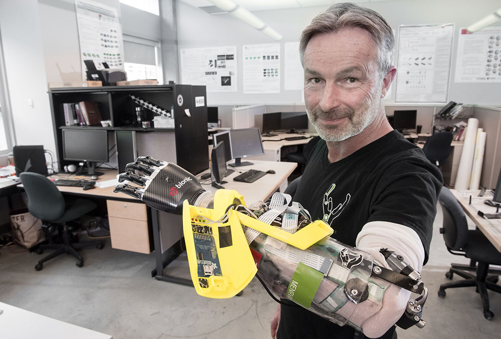 Danny Letain will be competing to do everyday tasks with the new bionic arm (SFU)